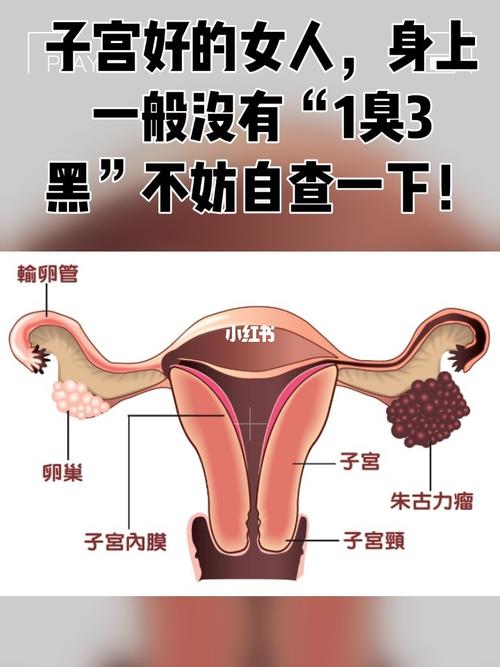 子宫好的女人身上一般没有1臭3黑不妨自测