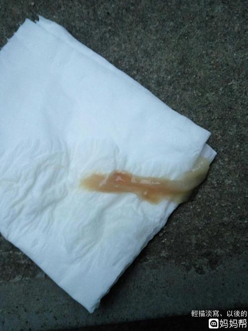 昨天去厕所一擦一直有蛋清白带,上边还带血丝