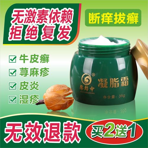 皮肤瘙痒止痒膏特效 过敏 面部_牛皮过敏止痒药膏癣藓药皮肤中药专用