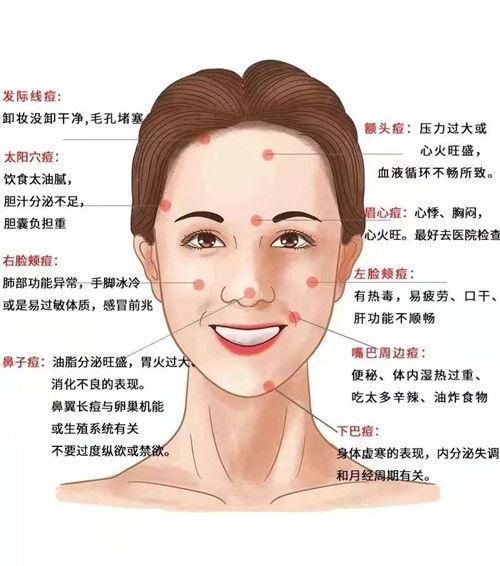 那在中医学上,脸部起痘的原因又是什么呢?