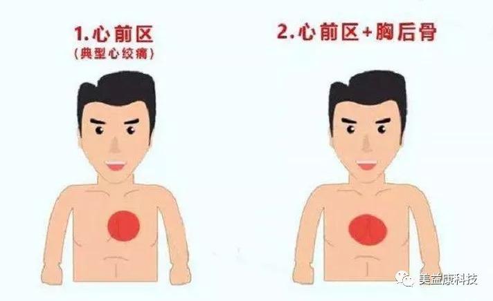 如何分辨真假心绞痛