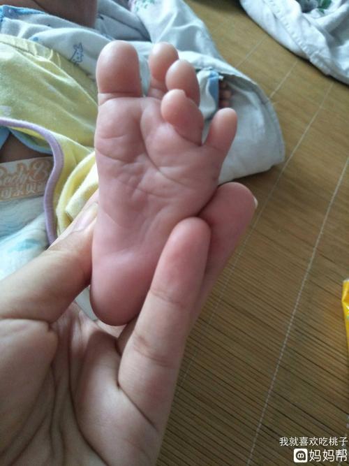 宝宝刚出生的时候脚趾就是这样