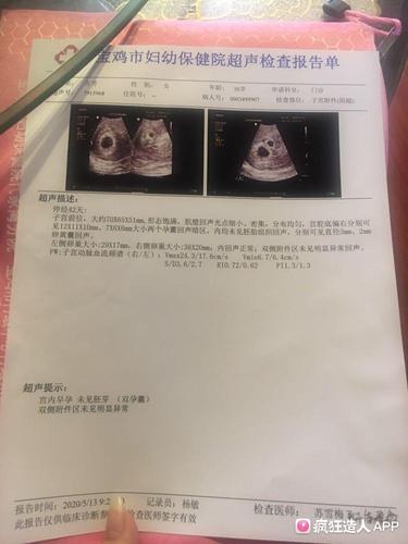 去年九月胎停,现在自怀双胞胎,慌的一匹啊