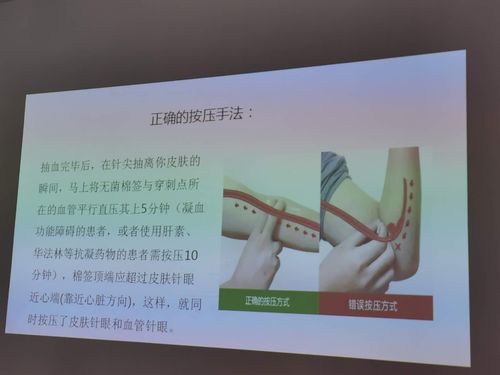 静脉采血后您正确按压了吗?
