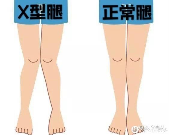 x型腿改善攻略|先学会自查再自纠!简单易操作的6个改善动作!