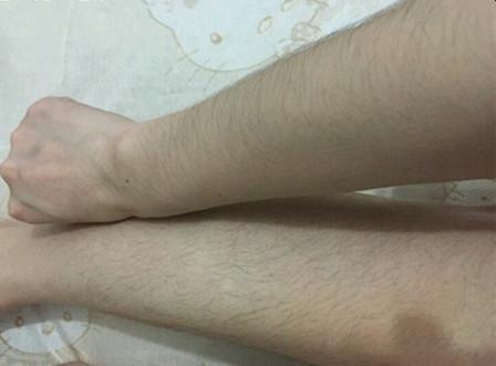 大家明明都是女生,为啥有的女生体毛旺盛,有的女生光秃秃呢?