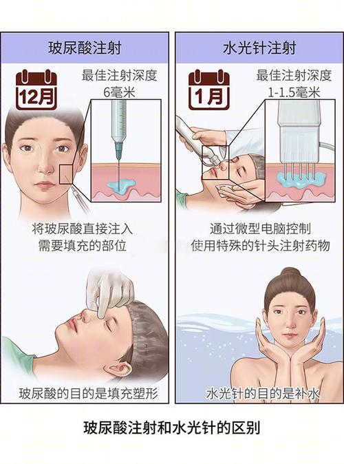 填充的深度主要视注射的部位不同而定,通常会比水光针注射的深度更深
