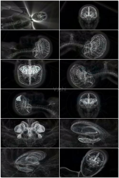核磁共振ct扫描b超临床护士检查诊断身体抵抗力免疫功能脑科颅脑感官