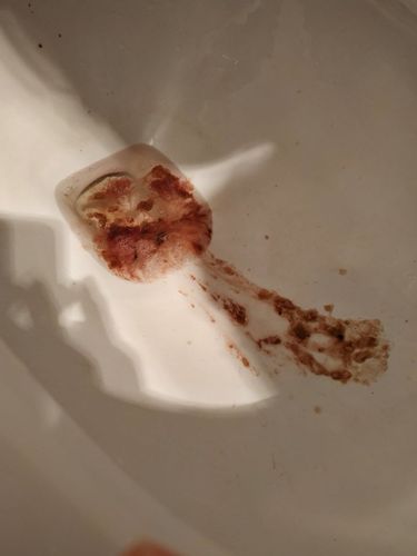 媳妇13周了 还吐 两个月只有一天没吐过 昨天吐血了