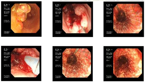 内二科(消化内科)介绍