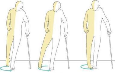 偏瘫是怎么一回事儿-成都哪所医院治偏瘫好?-名医汇