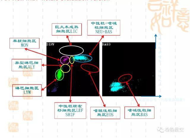 常见血液病血细胞散点图分析