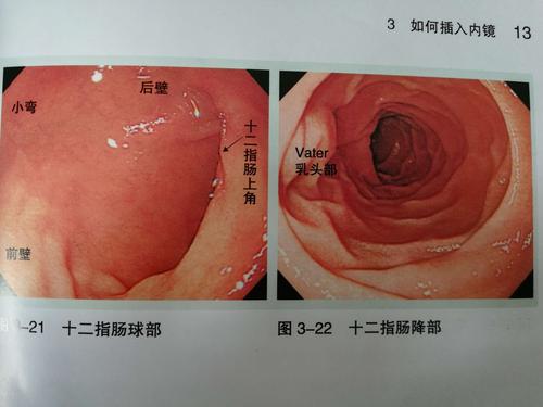新安县人民医院消化科胃镜室
