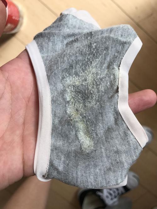 这样的白带正常吗