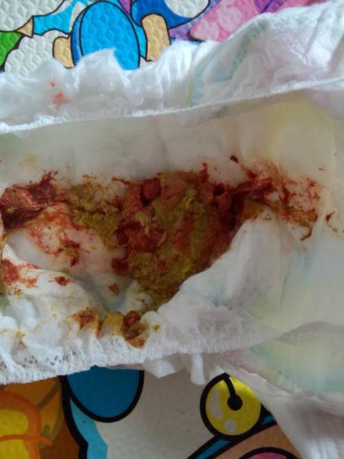 宝宝8个多月 前天拉肚子带血丝 医生开了头孢地尼分散