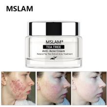 跨境mslam茶树修护去痘面霜acne scar removal skin repair cream