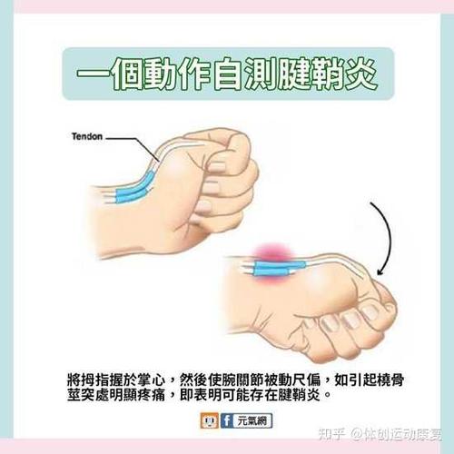 经常用手机导致大拇指疼痛怎么办?