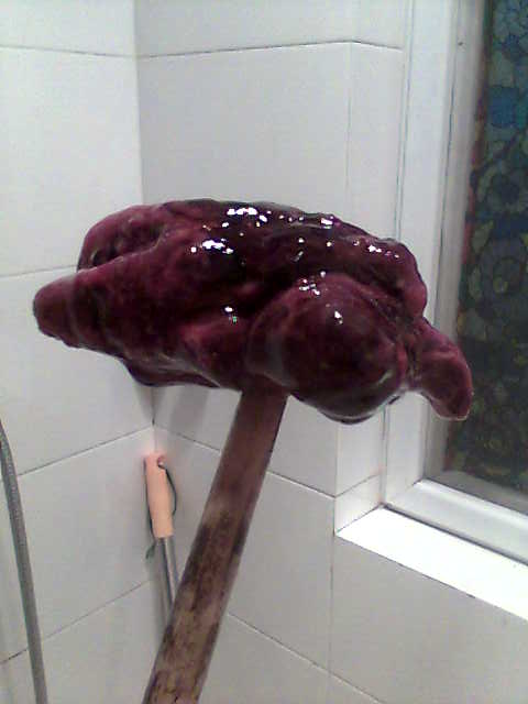 急!药流第八天从阴道流出不明物体~(懂的人请进)