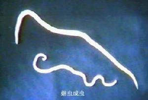 人类感染是由摄入弓蛔虫卵污染的食物所引起的.