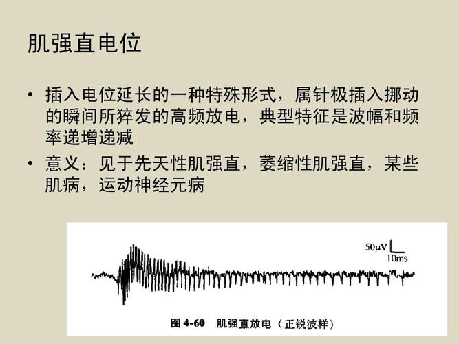 肌电图科内讲座ppt