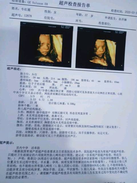生儿子的四维彩超图片妈妈生孩子过程作文怎么写