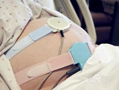 孕妇待产需要做什么准备