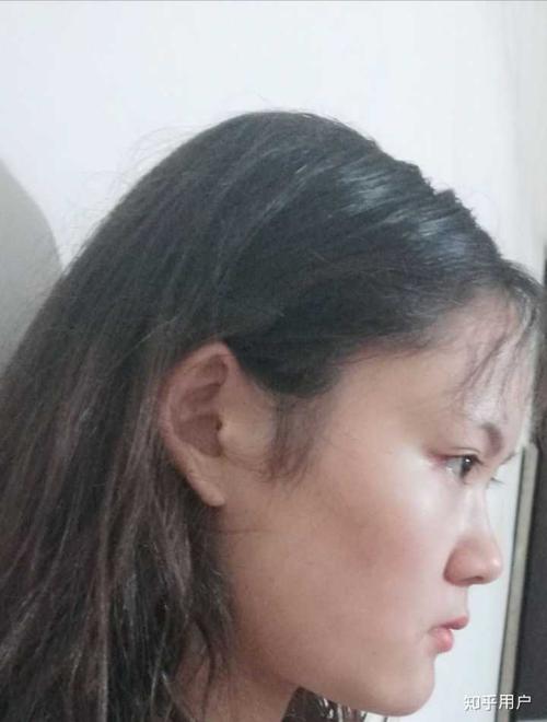 月亮脸?鞋拔子脸?是不是很丑?