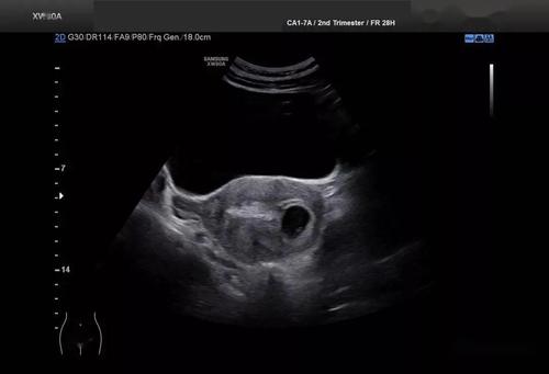 回答超声医师几个问题