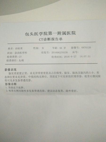 脑部ct拍片报告有一句为:除外骨折是什么意思?