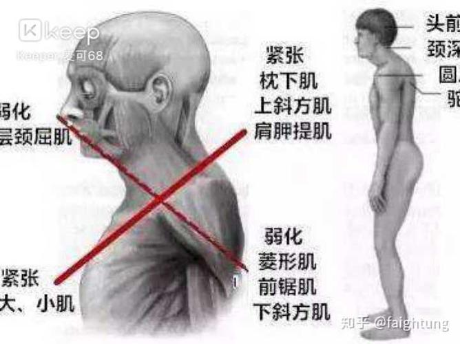 如何纠正含胸,驼背,头前伸?
