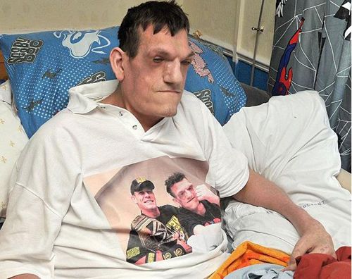 英国"巨人症"男子罗伯特·史密斯高超2米仍在长