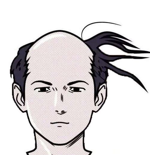 秃顶男人该怎么选择自己的发型?