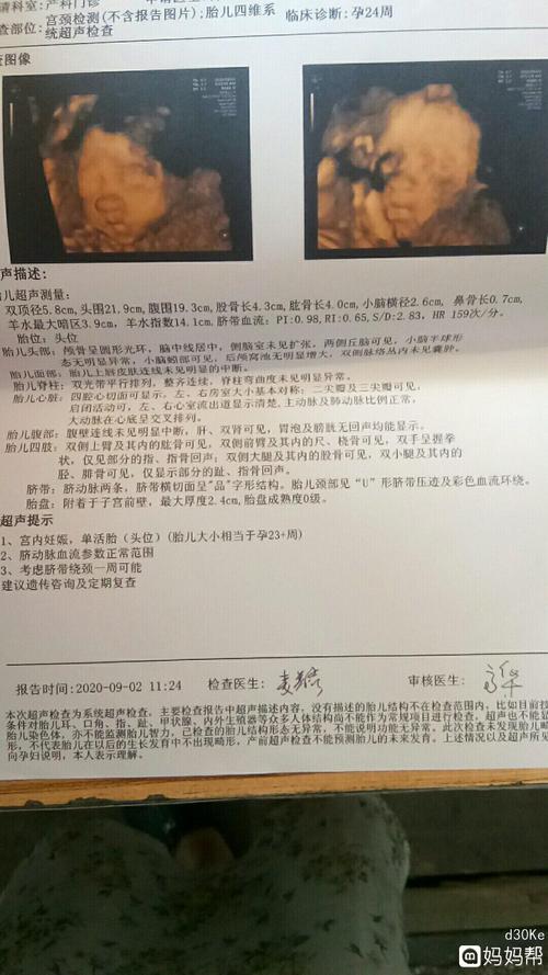 四维一次过,谢谢宝宝配合,初次见面,大鼻子