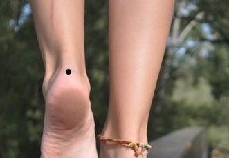 脚踵长痣脚后跟长痣代表什么
