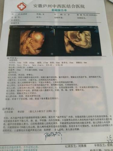 24周做的四维彩超 画圈圈的是不是小蛋蛋