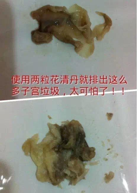 来自沈阳的顾客排出的垃圾