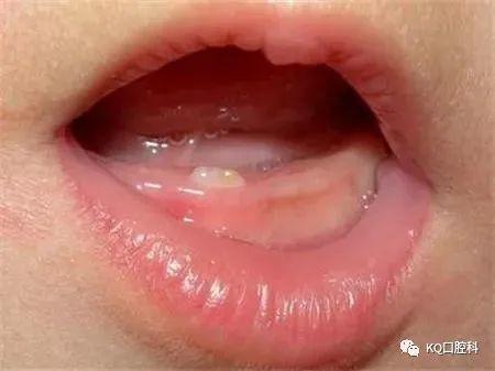 宝宝出牙问题大全推荐收藏