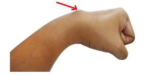 什么是癌症,肿瘤和肿块?懂点医学知识,无论男女老少都