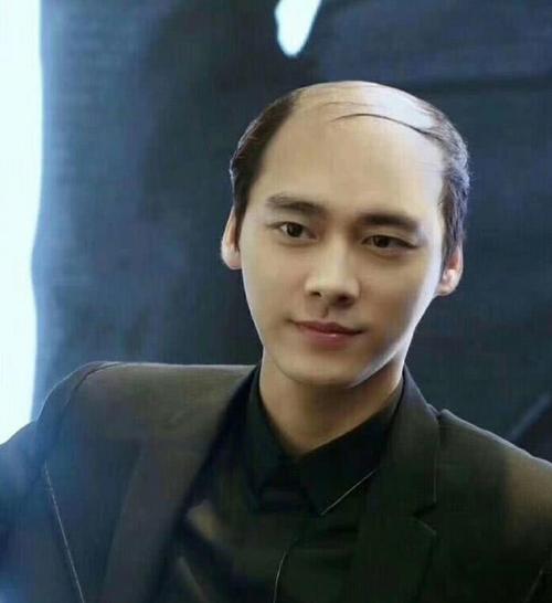 如果你的爱豆秃头会怎样?我赌100元,你肯定接受不了!