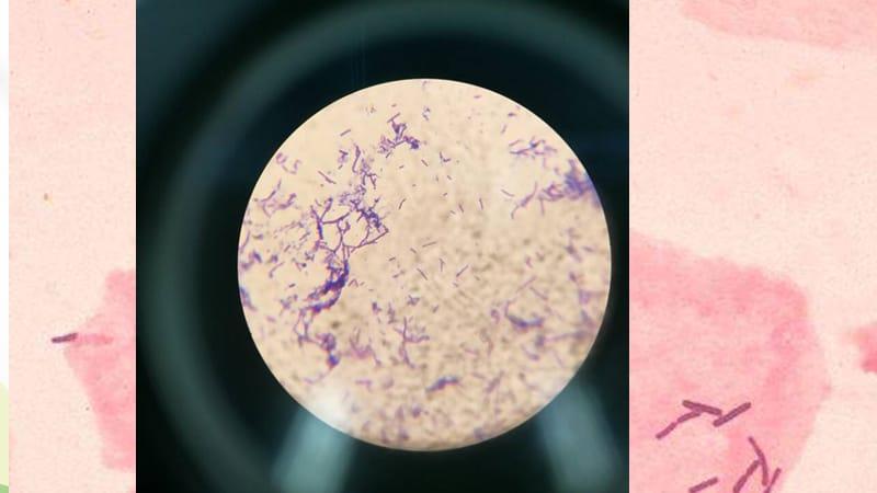 1组油镜下的乳酸菌ppt