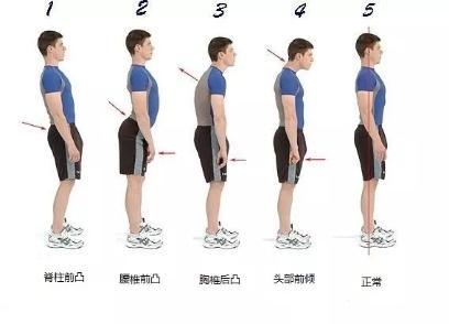 青少年暑期瑜伽班纠正孩子不良体态还原最健康的状态