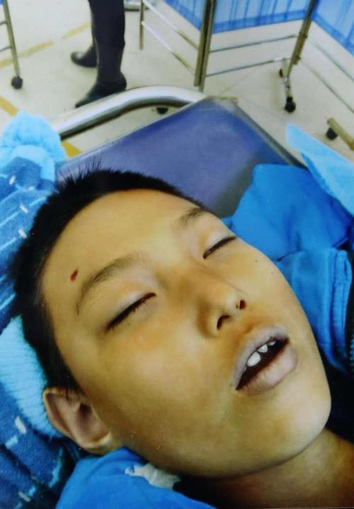 据了解,冠含当时瞳孔已经扩散,心电图出现室颤等情况.