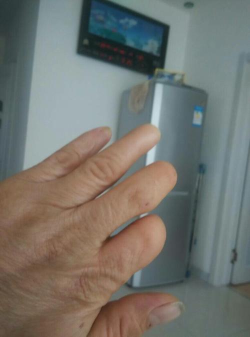 左手食指缺两节,中指缺一节,无名指缺少半节能否办理c1驾照