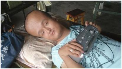 男子患"大头病" 无力行走卧病在床31年