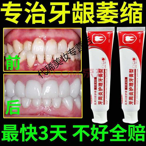 牙龈萎缩修复牙龈肿痛牙缝宽牙齿松动敏感牙周炎牙膏 一盒装