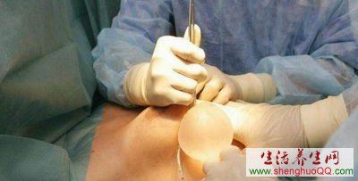 隆胸手术过程-图片