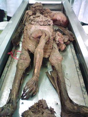 解剖学实验(看尸体,摸尸体以及内部东西)