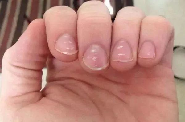 【艾美丽】指甲上的月牙,竖纹,白点代表什么?