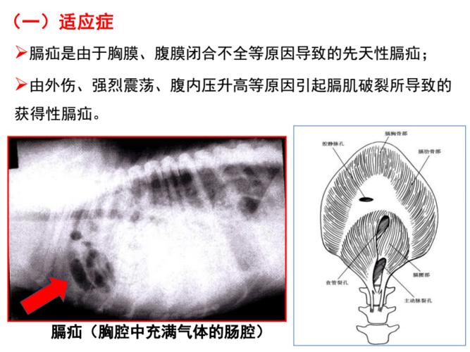 31 膈疝修补术ppt系统解剖学.pdf 26页