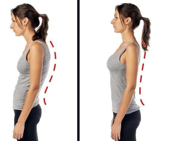 了解圆肩体态出现的原因圆肩体态会给我们带来哪些影响